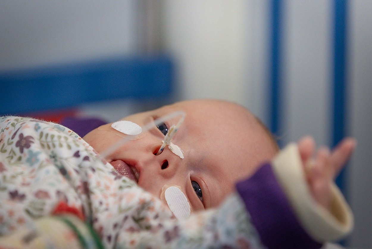 Das kleine Frühchen macht Fortschritte und wird Rund-um-die Uhr im Perinatalzentrum Rosenheim professionell versorgt. Das kleine Frühchen macht Fortschritte und wird Rund-um-die Uhr im Perinatalzentrum Rosenheim professionell versorgt.